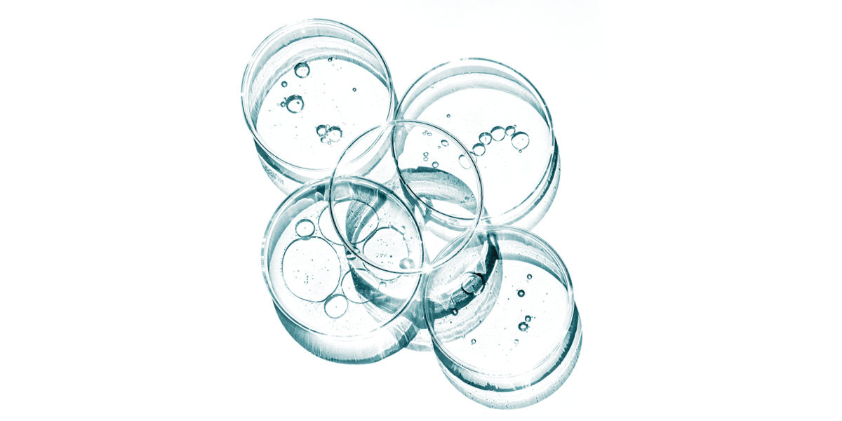 Microbiologie: uitdagingen én kansen Microbiologie_uitdagingen_kansen_BoerenZuivel